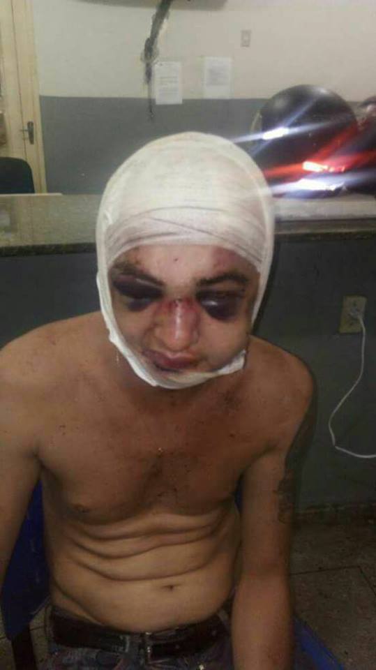 Surraço: casal tenta assaltar o Sacolão e é espancado por populares, após ser detido