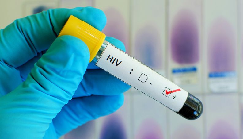 Epidemia de HIV na Europa cresce em ritmo alarmante, alerta OMS