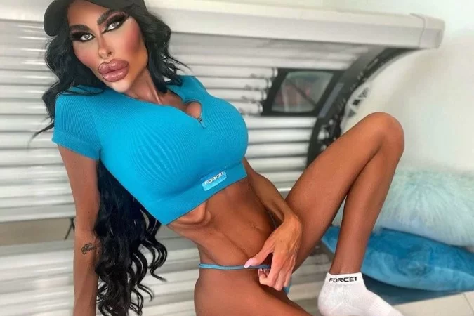 ‘Barbie Humana’ australiana já gastou R$ 1 milhão com cirurgias plásticas
