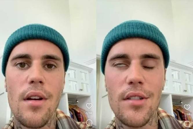 Cantor Justin Bieber pede orações ao revelar paralisia facial