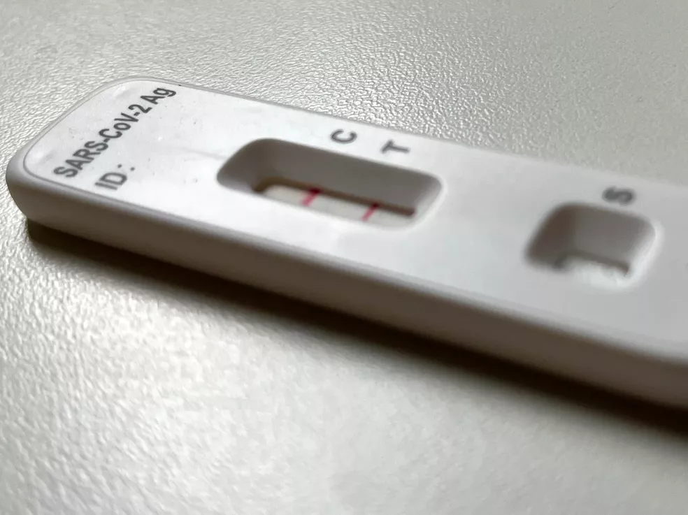 Procura por testes da COVID-19 aumentam em mais de 100% nas Unidades e Saúde de Natal