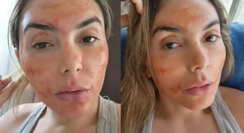 ‘Para manter pele jovem’: Modelo usa sangue menstrual como máscara facial