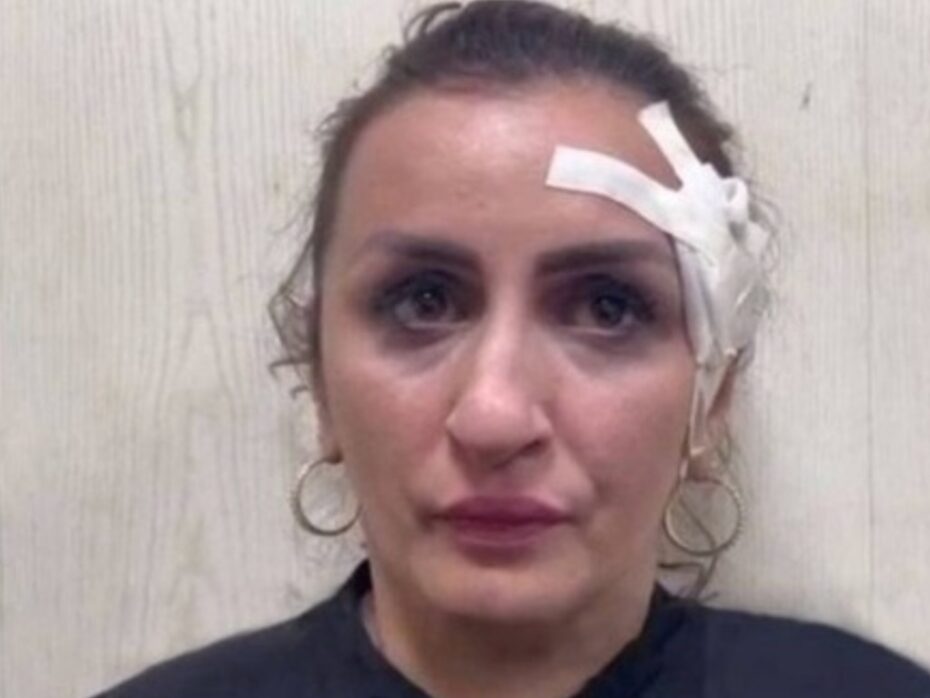 Mulher vende filho recém-nascido para financiar cirurgia plástica no nariz