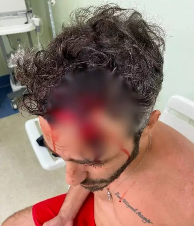 Ator Thiago Rodrigues é assaltado e espancado por bandidos no Rio
