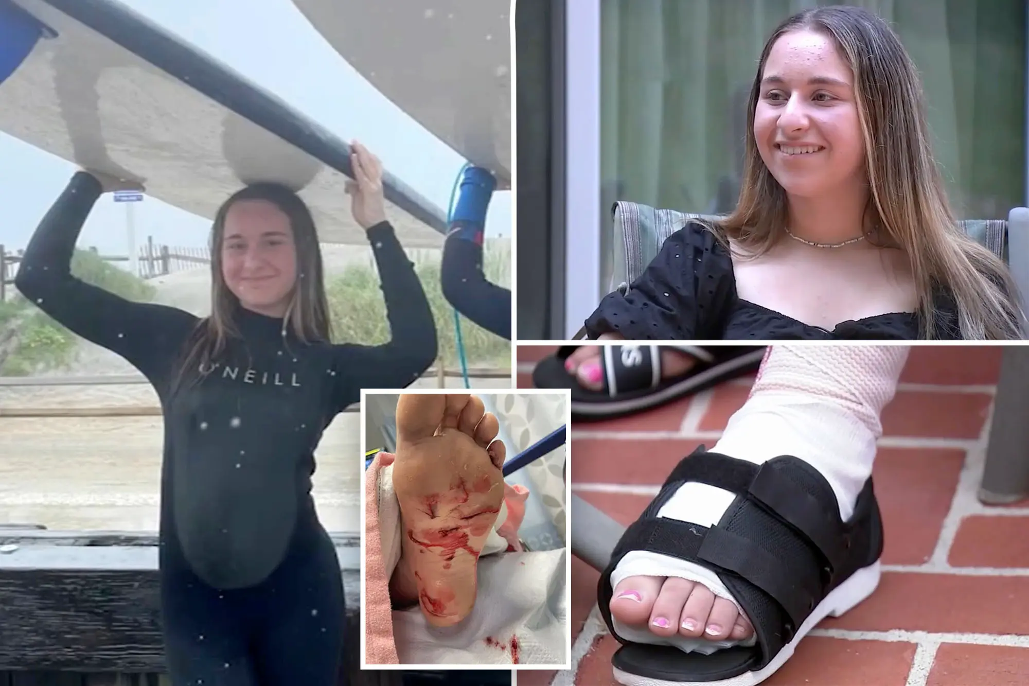 Surfista leva susto após ser atacada por tubarão: “Pensei que era um caranguejo me beliscando”
