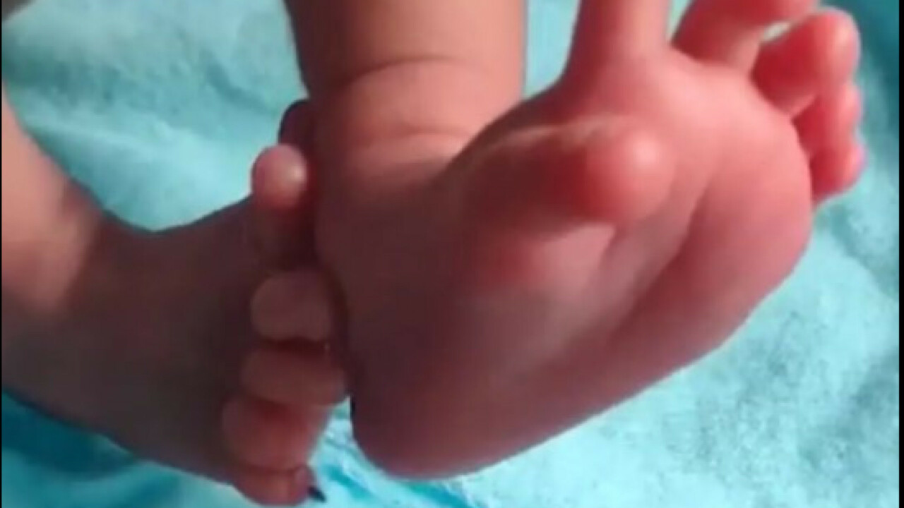 Menina nasce com 26 dedos e família considera como um “presente divino”