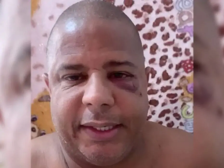 Com sinais de agressão, Marcelinho Carioca grava vídeo e diz que foi sequestrado porque saiu com uma mulher casada