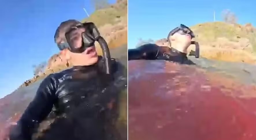 IMAGENS FORTES: banhista se filma sangrando após ataque de tubarão: ‘achei que ia morrer’