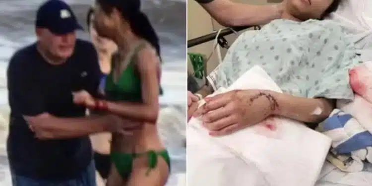 Turista é atacada por tubarão e consegue escapar dando socos na cabeça do animal