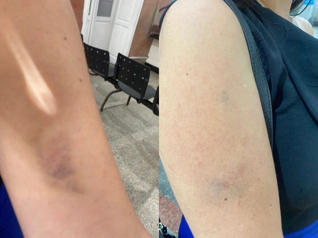 Jovem agredida constitui advogada e inicia processo criminal contra Arthur, bolsista do Idema