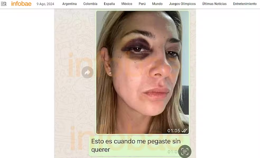 Após denúncia contra Alberto Fernández, fotos de ex-primeira dama com hematomas são reveladas