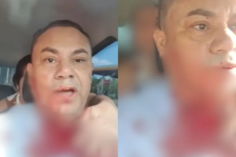 “Vão me matar e as autoridades não fazem nada”, desabafa empresário que sofreu atentado na Grande Natal