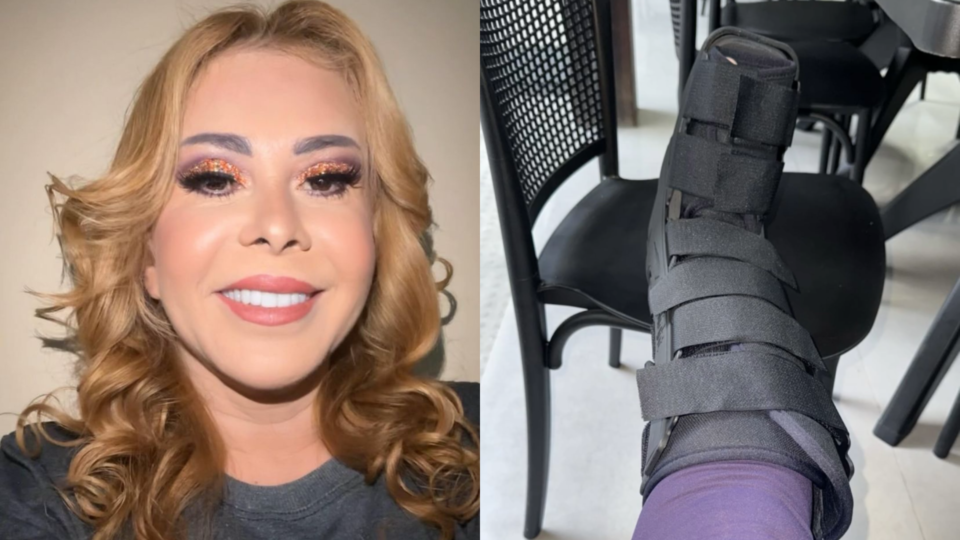 Joelma sofre acidente e terá que fazer show de cadeira de rodas
