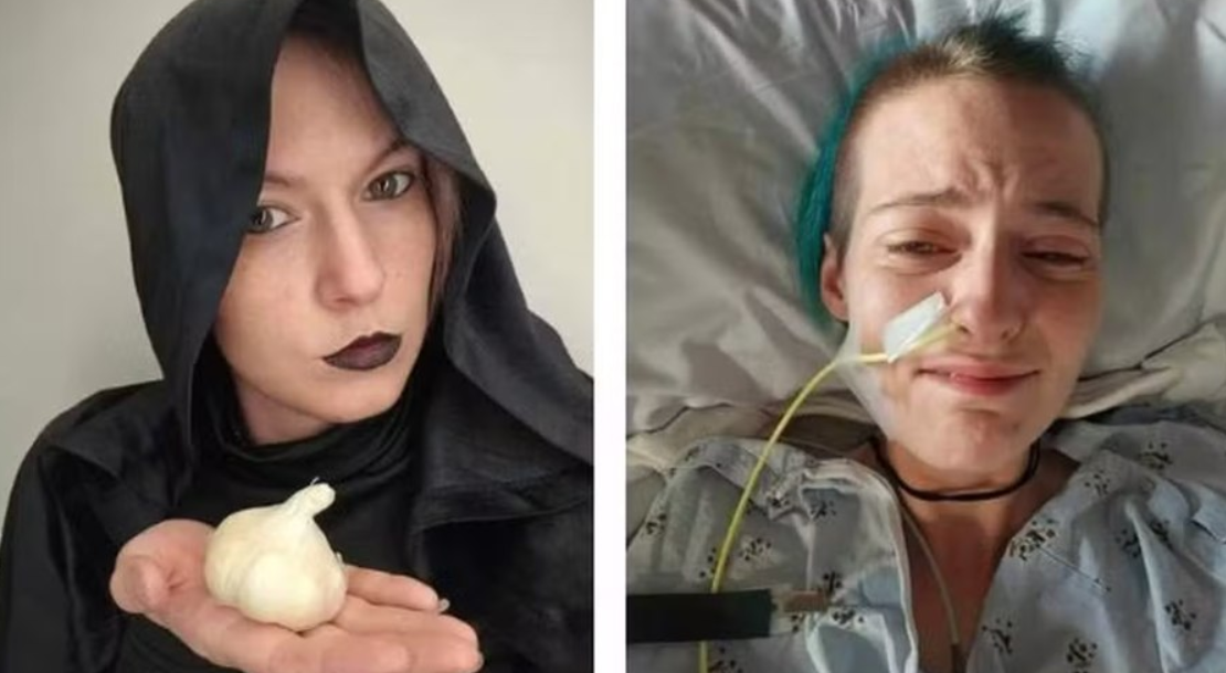 'Doença do Vampiro': distúrbio raro pode até levar à morte por ingestão de alho'