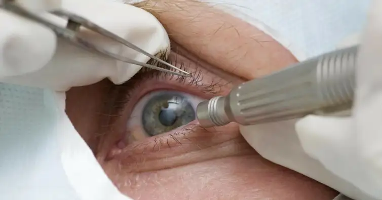 Pelo menos oito pessoas perdem olho após mutirão de cirurgia de catarata em Parelhas