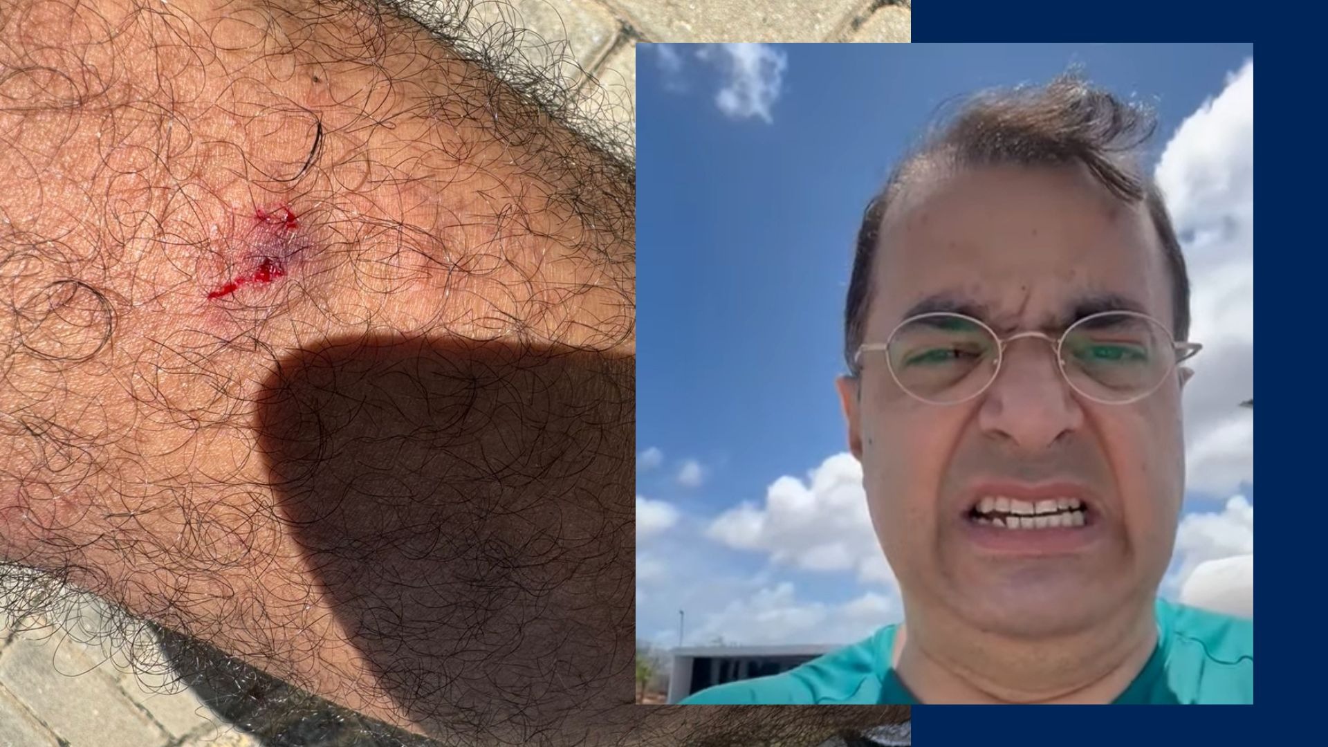 Advogado é atacado por "cães raivosos" no Parque da Cidade, em Natal