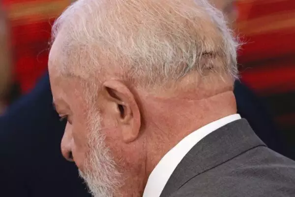 EMBOLIZAÇÃO: Lula fará novo procedimento cirúrgico na cabeça na manhã desta quinta-feira
