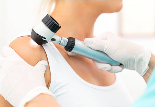 Sociedade Brasileira de Dermatologia promove campanha de prevenção ao câncer de pele em Natal