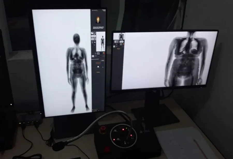 Justiça obriga RN a manter scanner corporal em todos os presídios para evitar revistas íntimas vexatórias