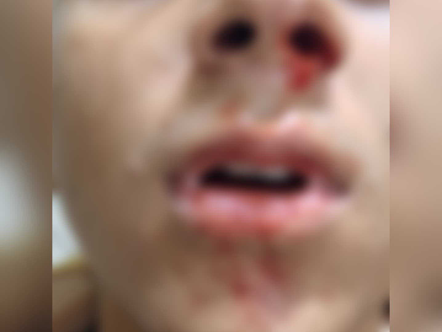 Policial rodoviário federal acusado de agredir crianças em Mossoró é afastado