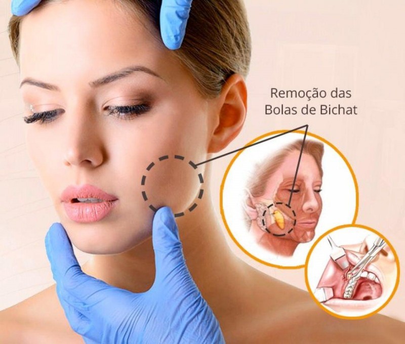 TJRN condena médico a indenizar paciente que não teve resultado prometido em cirurgia plástica