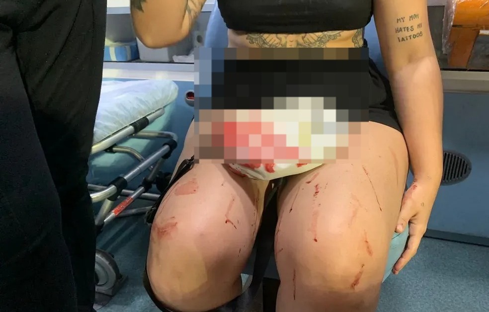 O PAU COMEU! Briga na Smart Fit do Carrefour Natal deixa suposta policial civil ensanguentada