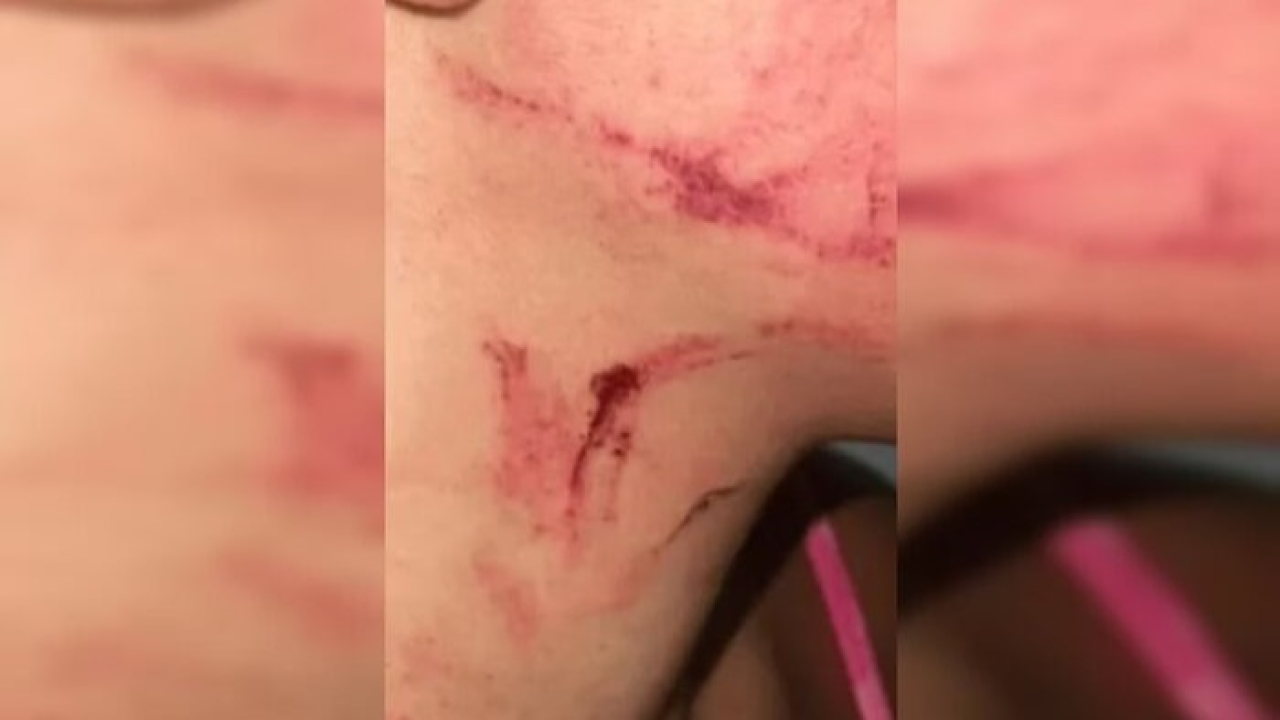 Suspeito tenta matar mulher por estrangulamento para beber seu sangue