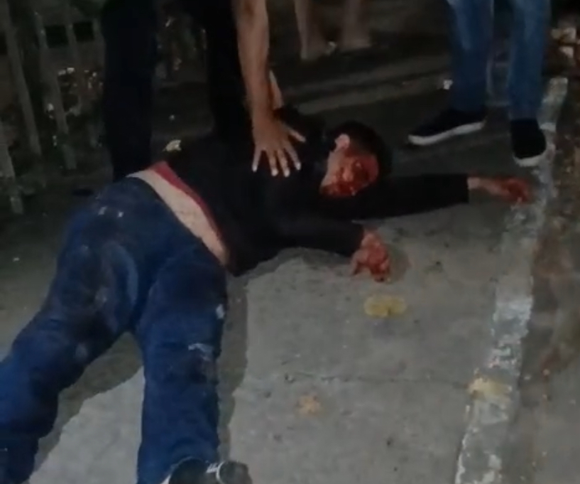 15 contra 1: Briga entre membros de organizadas de ABC e América deixam homem gravemente ferido em Natal