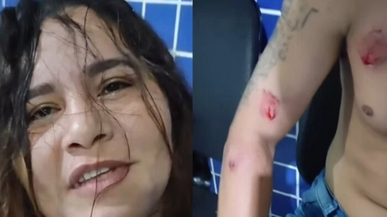 Mulher reage à traição com fúria e agride marido e amante a dentadas
