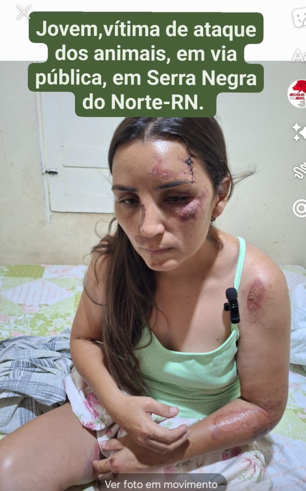 Mulher é atacada por cães de rua no centro de Serra Negra do Norte