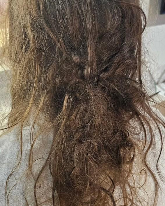 Adolescente sofre afogamento grave e caso acende alerta sobre cuidados em piscinas
