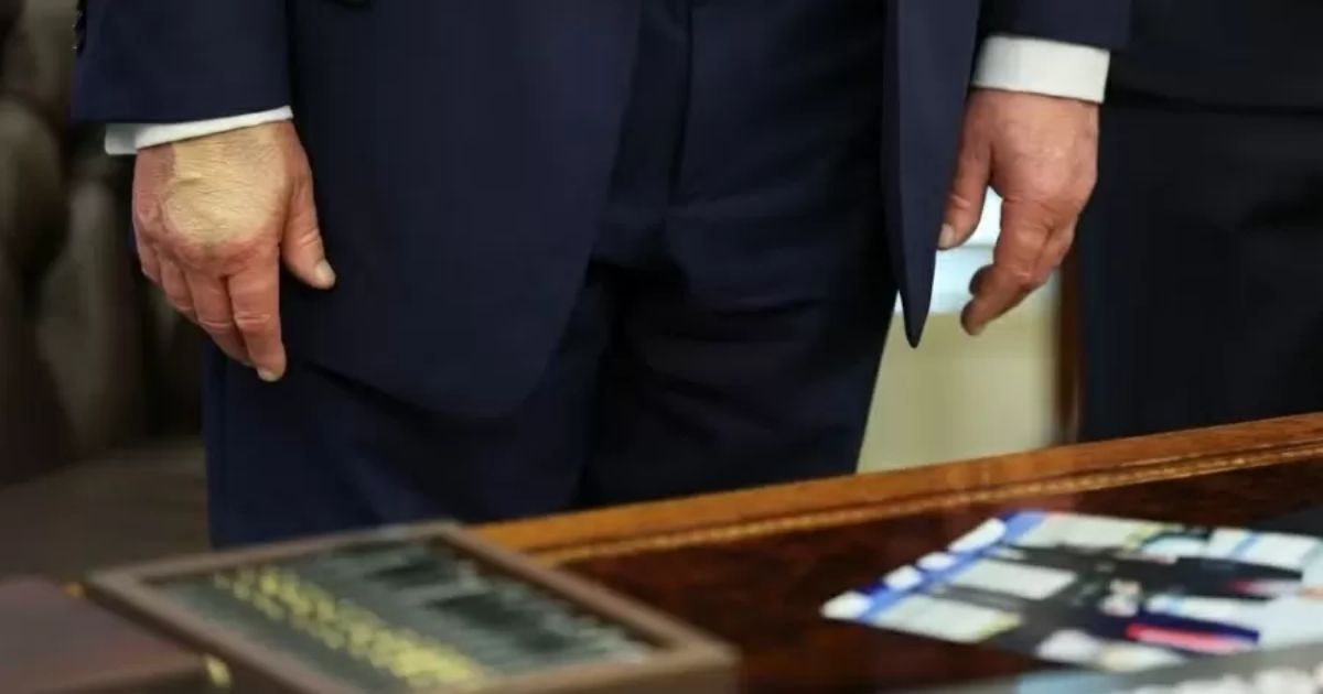 Mão maquiada de Trump chama atenção em evento e Casa Branca confirma doença