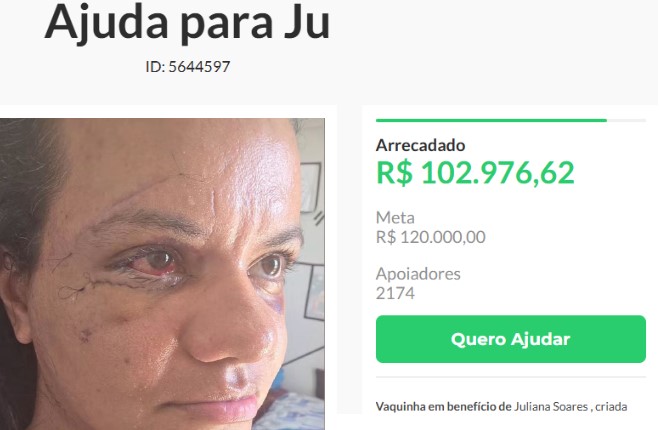 Vaquinha para tratamento de mulher agredida pelo namorado com mais de 60 socos arrecada mais de R$ 100 mil