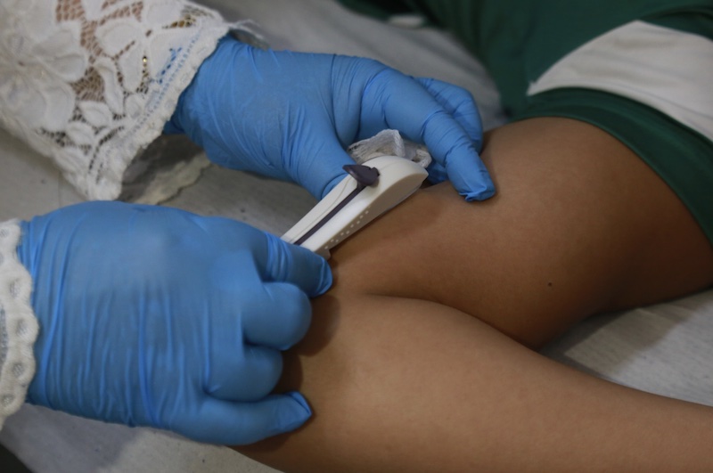 Prefeitura petista de Fortaleza implanta contraceptivo até em crianças de 10 anos