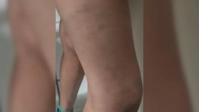 Pais cruéis usavam espeto de churrasco e pedaço de pau para torturar filhos