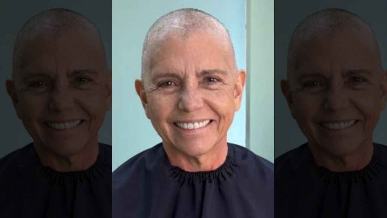Roseana Sarney mostra cabeça raspada na luta contra câncer