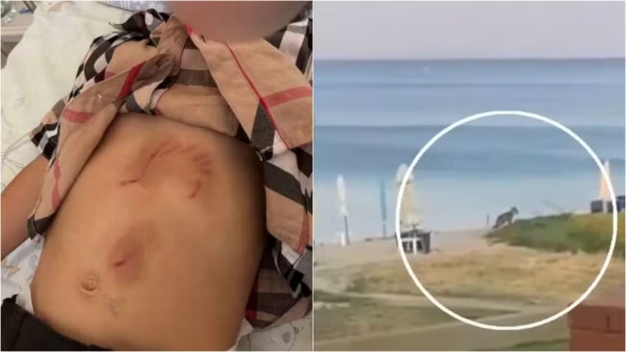 Menina de 5 anos é atacada por lobo em resort popular na Europa