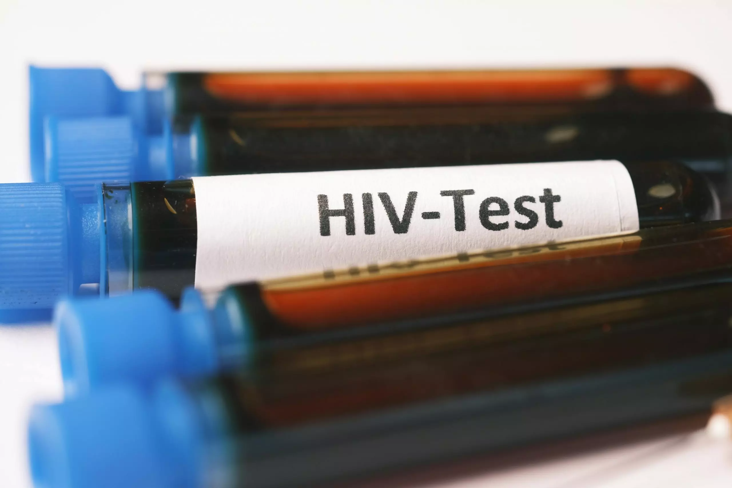Polêmica: Prefeitura publica lista com nomes de 600 pessoas que vivem com HIV