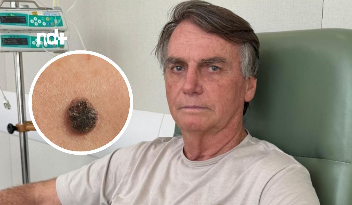 ‘Não foi só Bolsonaro’: Veja quem foram os outros 3 ex-presidentes diagnosticados com câncer