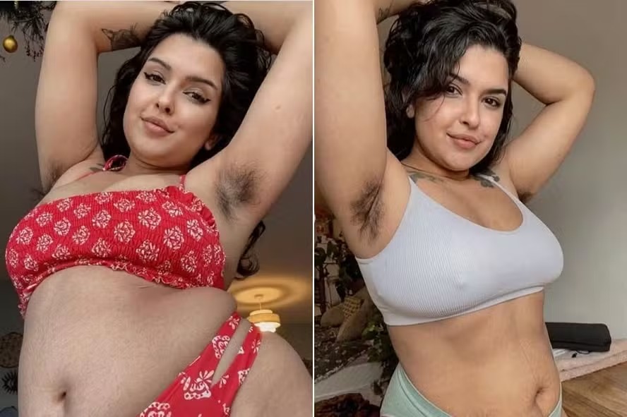 Ex-estudante de medicina faz 'fortuna' com pelos nas axilas e critica Kim Kardashian
