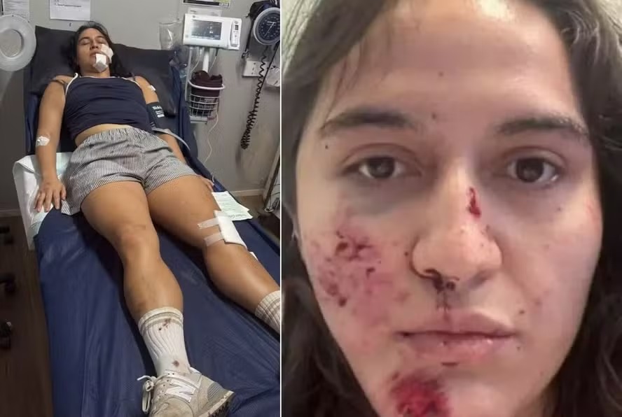 Ciclista sofre ataque de pássaro 'irritado' e tem múltiplas fraturas no rosto e no pescoço