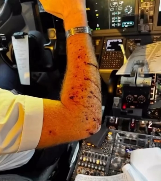 Piloto da United Airlines é ferido após suposto impacto de detrito espacial durante voo nos EUA
