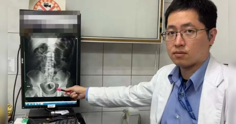 Homem com prisão de ventre descobre xícara no ânus em hospital