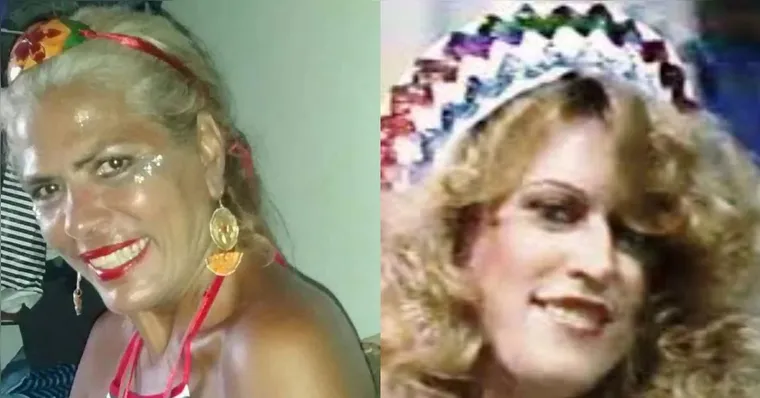 Ex-chacrete morre após ser atacada por pitbull do filho