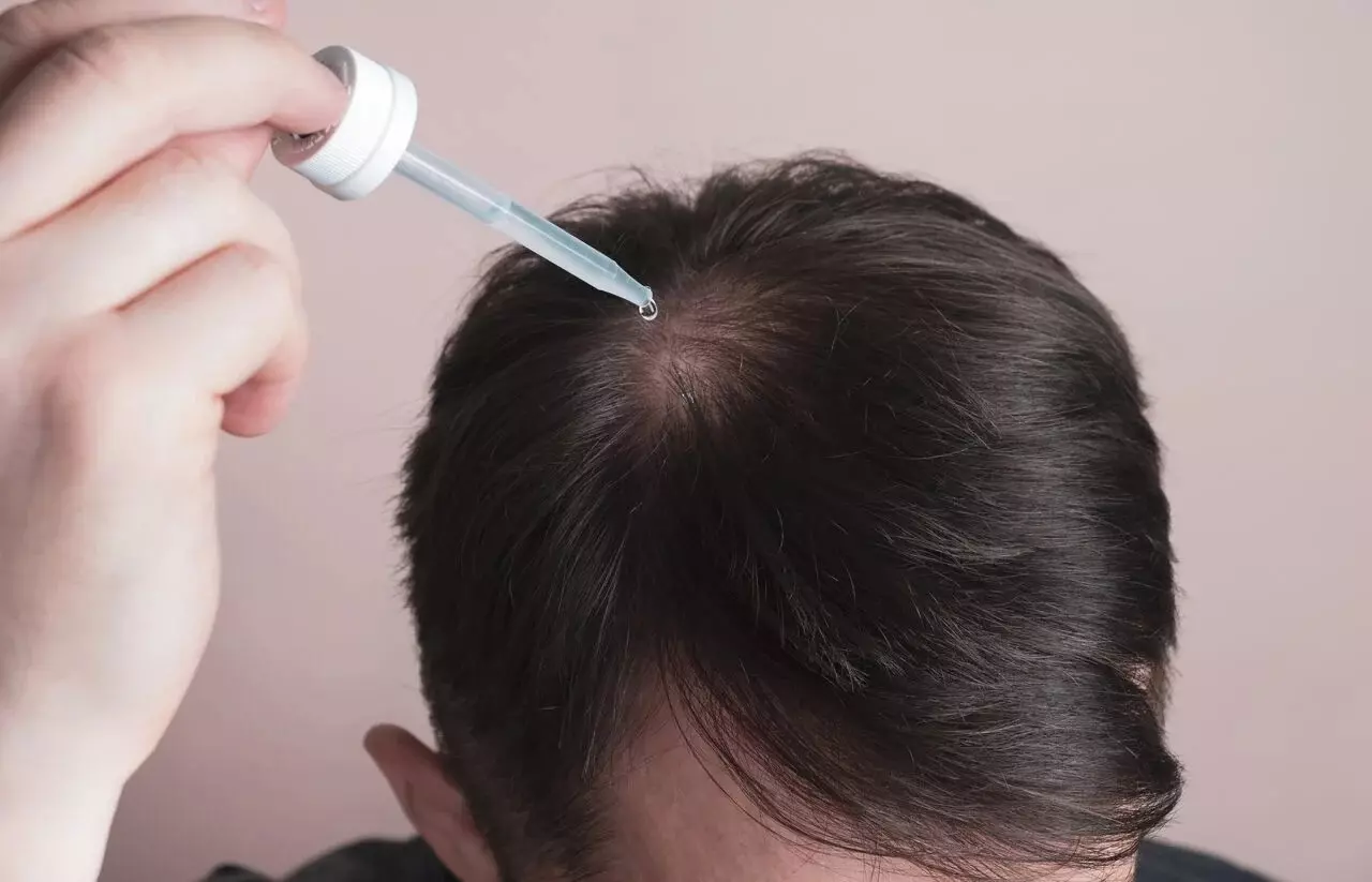 ‘Falso minoxidil’: Anvisa proíbe tônico que prometia fazer o cabelo crescer e mais 5 produtos
