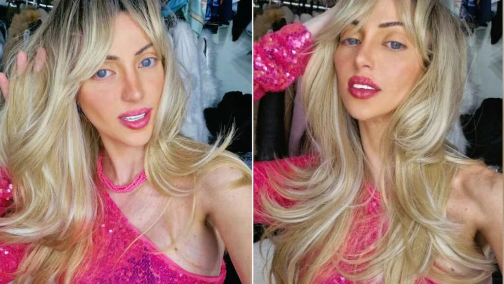 Perícia: Barbie humana morreu por overdose de cocaína
