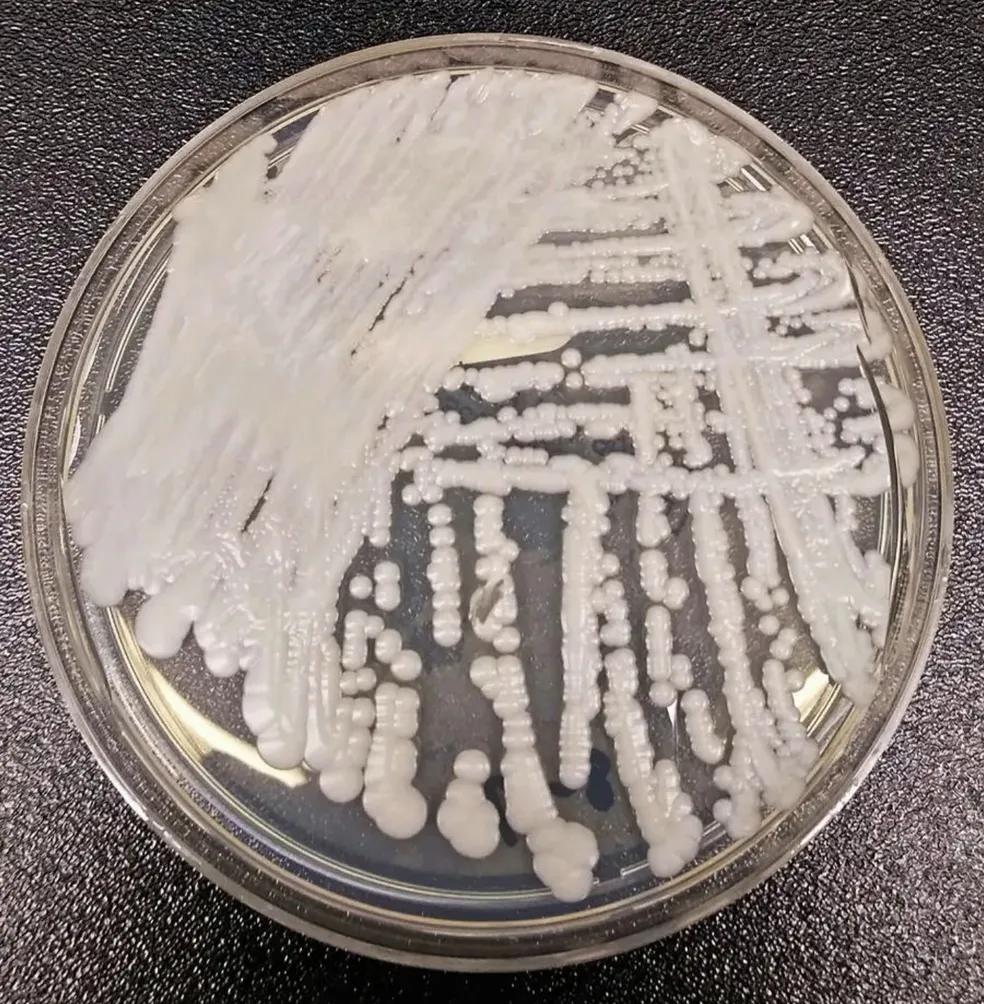 RN registra primeiro caso de contaminação por ‘superfungo’