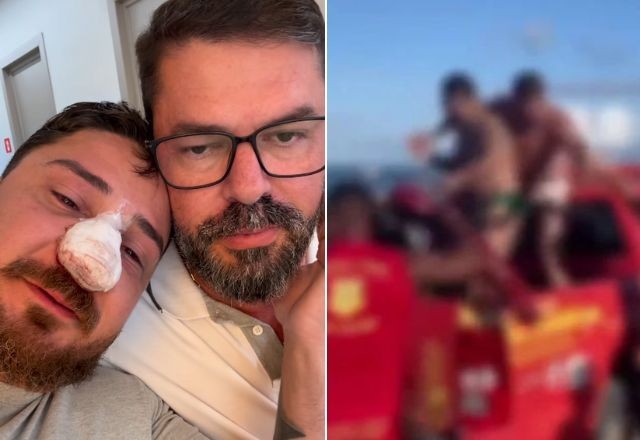 Turista agredido em Porto de Galinhas passa por cirurgia para corrigir quatro fraturas no rosto