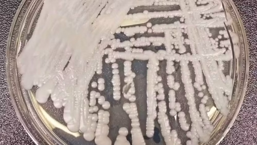 Anvisa acompanha infecção por Candida auris em paciente internado no RN