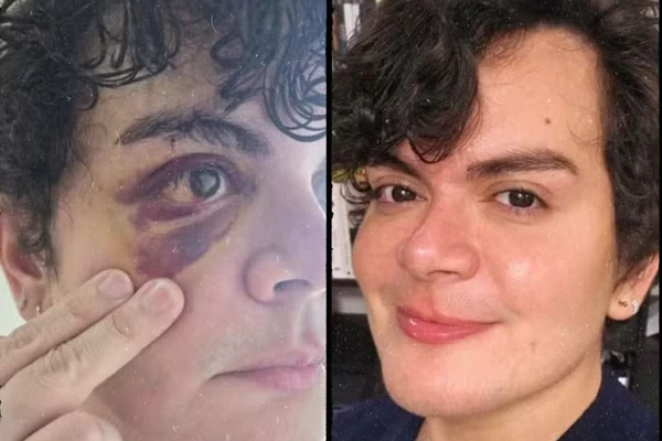 Médico tem apartamento invadido e é espancado por vizinho: 'Falava que eu era viadinho’